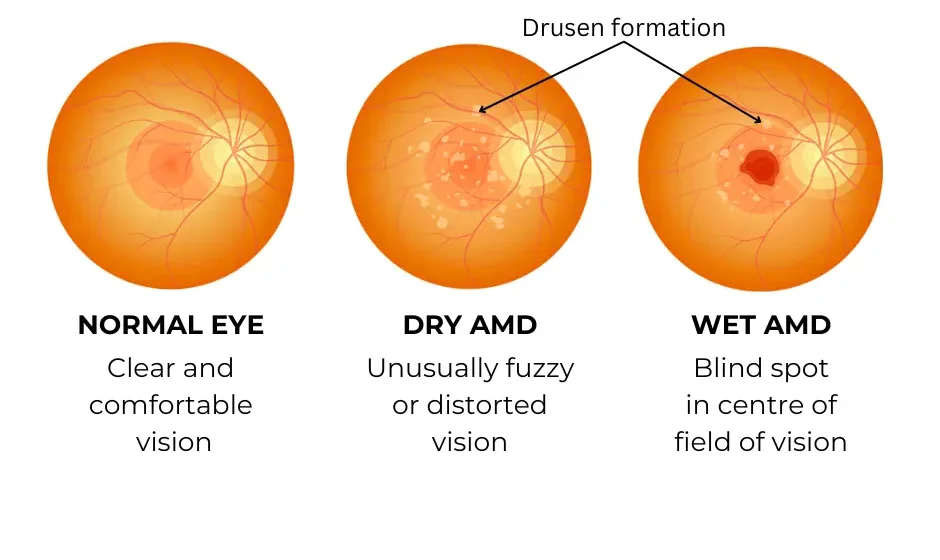eye types amd vector