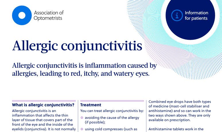allergic conjunctivitis